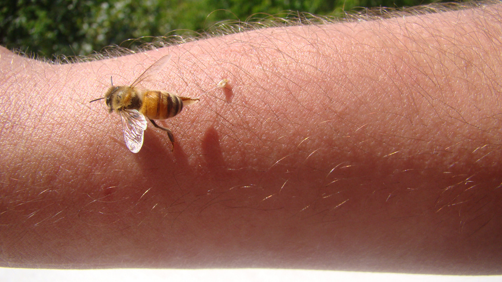 Jak vytáhnout včelí žihadlo?