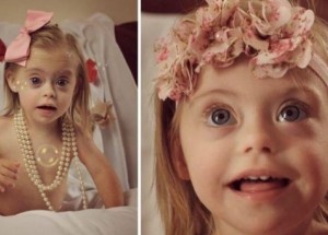 Dvouletá holčička s Downovým syndromem je novou batolecí modelkou