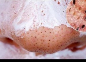 Díky dvěma ingrediencím se hravě zbavíte černých teček