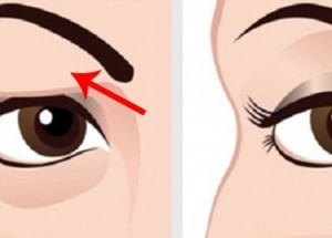Nejúčinnější lék na povislá oční víčka - Výsledky jsou skoro ihned!