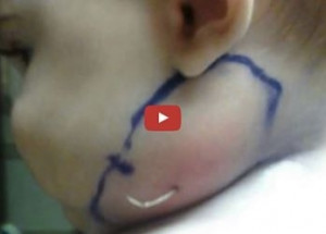 Přivezli jejich děťátko k doktorce s boulí na krku. Ta když na ni poté zatlačila, nevěřili vlastním očím!