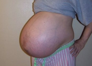 Doktoři jí řekli, aby potratila 4 ze 7 životů, které nosila v bříšku. Pohled na děti po porodu vás dostane...