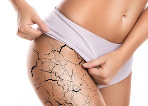 Boj proti striím: Co pomáhá?