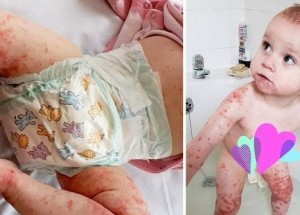 Tohle dokázal obyčejný polibek: Malá holčička se kvůli němu ocitla na pokraji smrti