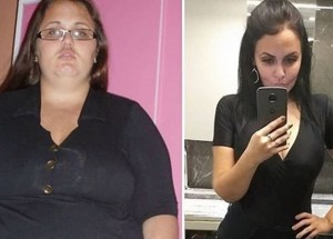 Brazilská blogerka zhubla 90 kilogramů: Bandáž žaludku jí dala šanci na nový život