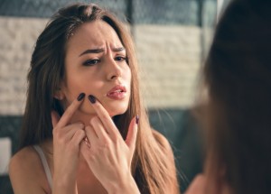 Akné na bradě, čele či tvářích odráží váš zdravotní stav