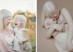 Slavné albínské sestry z Kazachstánu: Asel a Kamila Kalaganovy dobyly Instagram