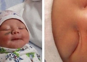 Miminko v Rusku přišlo na svět s jizvou pod okem. Lékaři jej poranili při císařském řezu