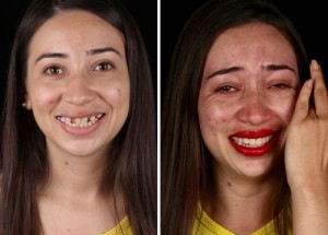 Brazilský zubař vrací zadarmo chudým lidem úsměv. Díky dokonalému chrupu se jim navrací i ztracené sebevědomí