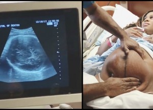 Angličanka Vanessa Fisher nechtěla rodit císařským řezem. Lékař pomocí techniky ECV obrátil dítě do správné polohy