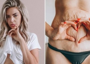 Kanaďanka Sarah Nicole Landry zhubla po porodu 50 kilogramů: Na Instagramu ukazuje, jak vypadá tělo skutečné ženy