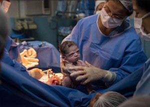 Brazilská holčička Isabela přišla na svět s naštvaným výrazem. Ihned se stala miláčkem sociálních sítí