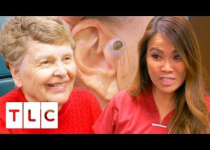 55 let měla na obličeji pupínek. Záběry z odstraňování jsou jen pro silné povahy!