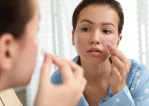 Náplasti na pupínky vás zbaví akné přes jedinou noc. Jak fungují?