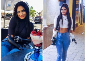 Beyza Mokka je velká bojovnice. Meningokok ji připravil o ruce a nohy, snaží se ale žít na 100 procent dál