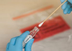 Koronavirus v Česku: Celkem 11 984 nově potvrzených případů za úterý 20. října, jde o nejvyšší denní nárůst