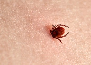 Klíšťová encefalitida je zrádná nemoc. Všímejte si varovných příznaků tohoto onemocnění