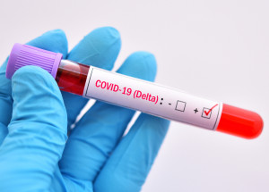 V Česku se již delta mutace koronaviru šíří komunitně, uvádí Státní zdravotní ústav