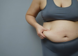 Influencerka zhubla 145 kilogramů. Fotky jejího těla s převislou kůží jsou jen pro silné povahy