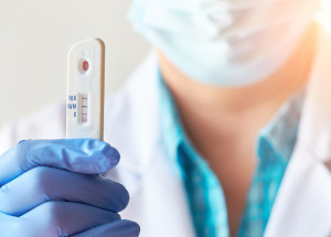 36 procentům lidí, kteří prodělali covid, se nevytvořily protilátky. Tvrdí výzkum americké University of Pennsylvania