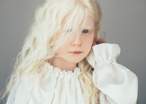 Albínská holčička Ava Clarke si podmanila slavné módní značky. Podívejte se, jak je krásná