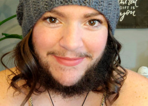 Kanaďanka má na tváři husté mužské vousy. Za její problém může syndrom polycystických ovarií