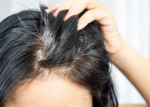 Objevili jste první šediny? Může to být i příznak nemoci