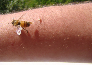 Jak vytáhnout včelí žihadlo? Spousta lidí to dělá špatně