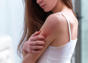 Na tuto rostlinu nikdy nesahejte. Může vám způsobit nepříjemné popáleniny