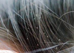 Maminka odmítá odvšivit dítě, protože je veganka. Příčí se jí zabíjet vše živé