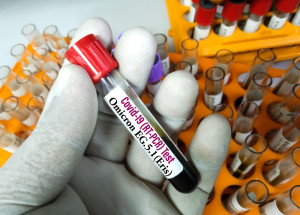 Mutace Eris je novou variantou covidu 2023. Má tyto příznaky