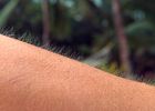 Roste vám na jednom místě vašeho těla dlouhý chlup? Poznejte tajemství, proč to tak je