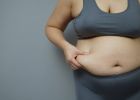 Influencerka zhubla 145 kilogramů. Fotky jejího těla s převislou kůží jsou jen pro silné povahy