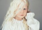 Albínská holčička Ava Clarke si podmanila slavné módní značky. Podívejte se, jak je krásná