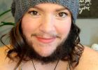 Kanaďanka má na tváři husté mužské vousy. Za její problém může syndrom polycystických ovarií