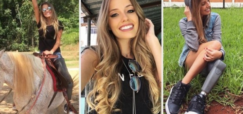 Tahle krásná dívka si i přes svůj hendikep dokáže užívat života