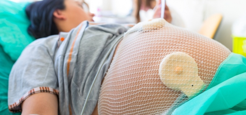 3 nejdůležitější fakta o císařském řezu. Tohle by měla znát každá žena!