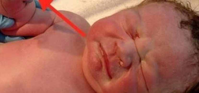 Neměl se vůbec narodit. Když po porodu lékaři otevřeli jeho pěst, zůstali jak opaření!