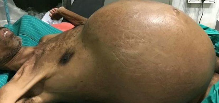 Nejdříve si mysleli, že je tento 49letý muž posedlý. Pak mu ale v břiše našli tohle...