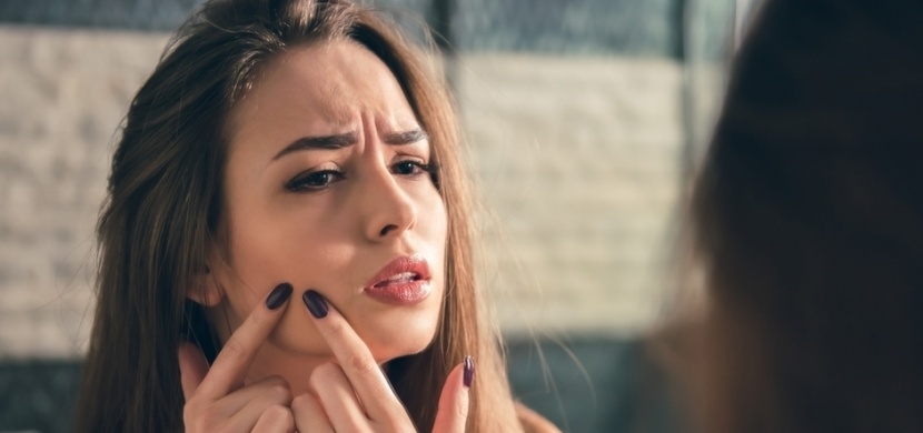 Osm největších "lží" o akné, které můžete slyšet. A je určitě dobré je znát!