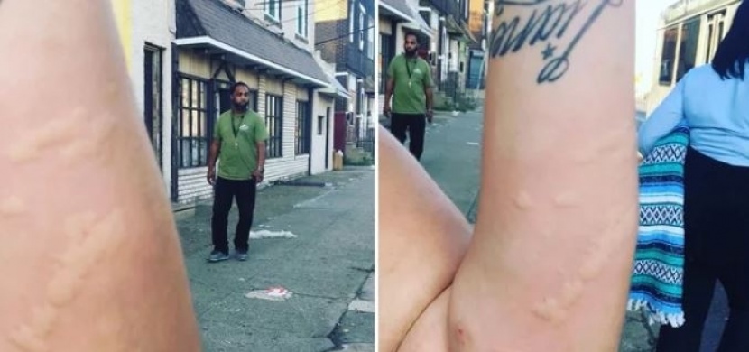 Ženu v autobuse pokousaly štěnice. Když se otočila, viděla, jak jich po sedadle lezou tisíce