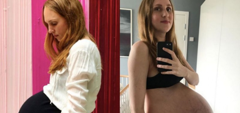 Žena šokovala sociální síť svým poporodním bříškem. Takhle vypadá měsíc po narození trojčat