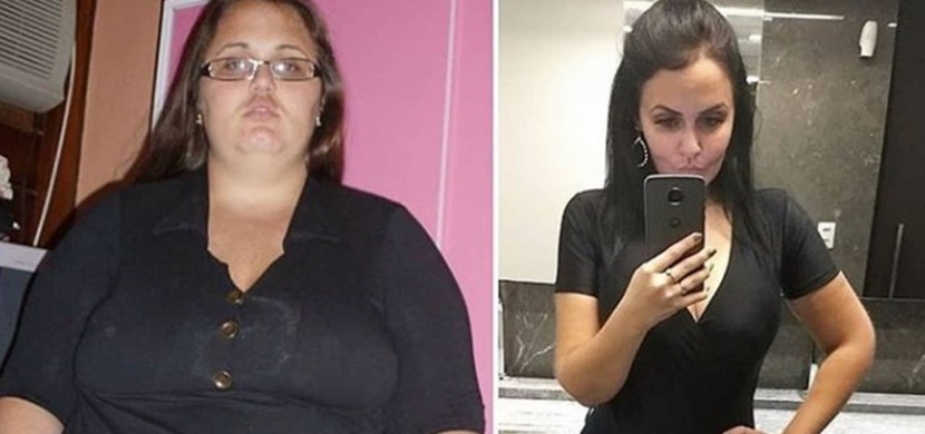 Brazilská blogerka zhubla 90 kilogramů: Bandáž žaludku jí dala šanci na nový život