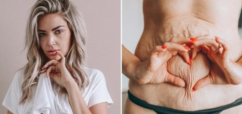 Kanaďanka Sarah Nicole Landry zhubla po porodu 50 kilogramů: Na Instagramu ukazuje, jak vypadá tělo skutečné ženy