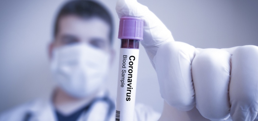 Vědci objevili protilátku, která zničí koronavirus. Našli ji v krvi vyléčených pacientů
