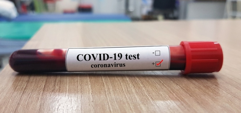 Stovky tisíc lidí na světě mohou být nakaženi koronavirem. O svém stavu nemají ani tušení