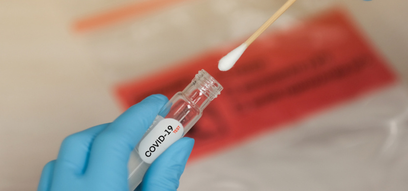 Koronavirus v Česku: Celkem 11 984 nově potvrzených případů za úterý 20. října, jde o nejvyšší denní nárůst