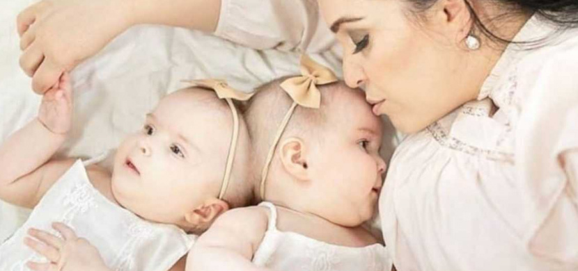 Siamská dvojčata spojená hlavičkami už mohou žít samostatně. Američtí lékaři je oddělili během náročné 24hodinové operace