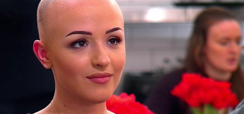 Žena s alopecií si během prvního rande sundala paruku. Video ukazuje, jak reagoval její partner