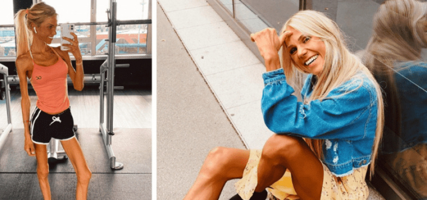 Hvězda Instagramu Josi Maria varovala před anorexií. Této nemoci však sama podlehla